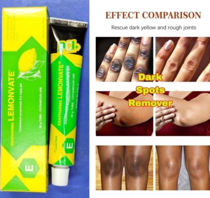 Lemonvate cream 30g