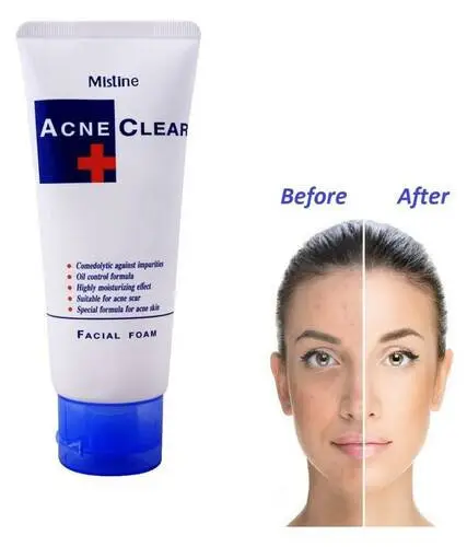 Mistine Acne Clear Facial Foam/Face wash - Image 2